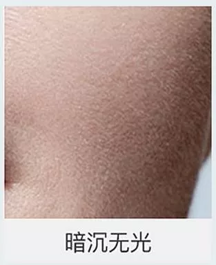 角质层的透明度降低。角质层储水充分皮肤就会清透明亮。反之，角质层干燥，明亮度下降，肌肤会暗淡无光。
